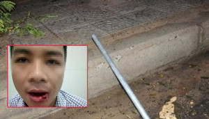 Thầy giáo ném tuýp sắt gãy răng hàng xóm