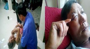 Đuổi 'cát tặc', hai nông dân bị đánh hỏng mắt, rách đầu