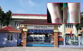 Tạm đình chỉ cô giáo bị tố đánh bầm tím chân 22 học sinh ở Bà Rịa – Vũng Tàu