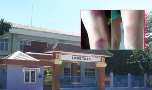 22 học sinh bị giáo viên đánh tím chân: Bộ GD&ĐT lên tiếng