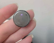 Nuốt cả viên pin, bé gái 5 tuổi nguy kịch