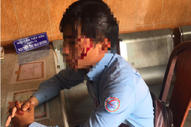 Bị chó cắn khi đi lấy số nước, nam nhân viên còn bị đánh vỡ đầu