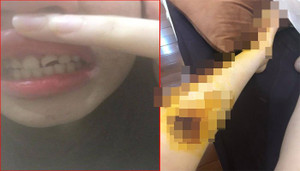 Người phụ nữ tố bị kẻ biến thái cố ý va chạm giao thông, sờ vào vùng kín rồi bỏ trốn khi bị chống cự