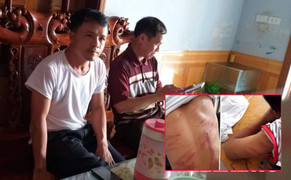 Nam sinh lớp 8 ở Hà Tĩnh bị bố đẻ đánh đập dã man
