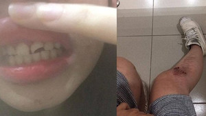 Kẻ biến thái cố tình gây tai nạn để xâm hại các cô gái trẻ tại Hà Nội