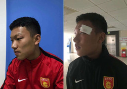 Đấm cầu thủ Trung Quốc chảy máu mặt, đàn em Quang Hải nhận án phạt cực nặng