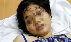 21 ngày sống trong 'địa ngục' của cô gái 9X bị tra tấn đến sẩy thai