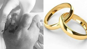 Mắc nhẫn vào cửa xe ô tô tải, người phụ nữ mất cả ngón tay