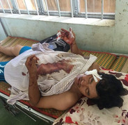 Xã đội trưởng bị 'cát tặc' chém trọng thương: Công an Bình Thuận vào cuộc điều tra