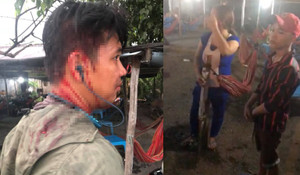 Tố chủ quán ‘chặt chém’, hai vợ chồng bị đánh đập dã man ở Long An