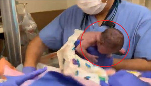 Clip: Bác sỹ tuột tay đánh rơi bé gái sinh non, nghi khiến bé xuất huyết não