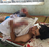 Bắt kẻ khai thác cát trái phép, chém xã đội trưởng trọng thương ở Bình Thuận