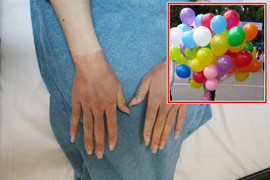 4 người đàn ông nhập viện khẩn cấp do bỏng khí hydro