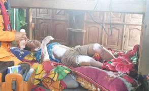 Cứu nạn thành công một thuyền trưởng tàu cá bị bỏng nặng trên biển