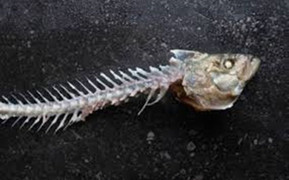 Nuốt xương cá, người đàn ông tắc ruột suýt chết