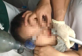 Hóc thạch rau câu, bé 2 tuổi tại Nghệ An suýt chết