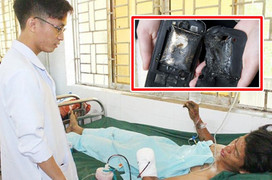 Điện thoại nổ khi đang sạc, thanh niên 22 tuổi ở Đồng Nai mất bàn tay