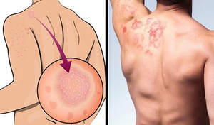 Tác hại khôn lường khi bạn không tắm rửa