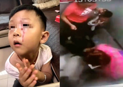 Bé trai bị chó khổng lồ tấn công trong thang máy