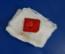 Cụ bà 76 tuổi uống thuốc nuốt luôn cả vỏ phải nhập viện cấp cứu