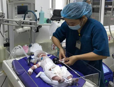 Cứu sống bé sơ sinh bị ngạt khí trong bụng người mẹ đã qua đời