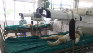 Ba trẻ mầm non bị bỏng do cô giáo đốt cồn dạy học: Hai nạn nhân được ghép da