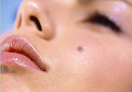 Đây là những quan niệm sai lầm về ung thư da nhiều người cần chú ý