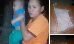 Xác minh thông tin bác sĩ bỏ quên băng gạc trong bụng sản phụ