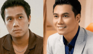 Vẻ ngoài của Việt Anh thay đổi thế nào từ lúc mới vào nghề tới khi phẫu thuật thẩm mỹ?