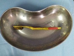 Hy hữu, người đàn ông nuốt cả bàn chải đánh răng vào bụng