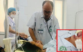 Bệnh hiểm ăn mòn cánh mũi trở lại Việt Nam sau nửa thế kỷ 'mất tích'