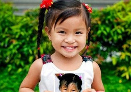 Phẫu thuật miễn phí cho trẻ em dị tật hàm mặt