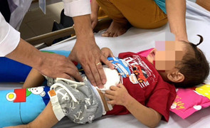 Cắt bỏ khối u nặng gần 500 gram ở vùng bụng dưới cháu bé 2 tuổi