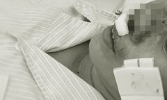 Những bệnh nhân nhập viện Bạch Mai do nhiễm 'vi khuẩn ăn thịt người' Whitmore giờ ra sao?