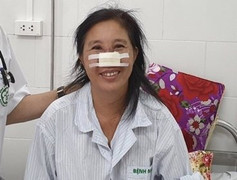 Người phụ nữ bị vi khuẩn Whitmore 'ăn' cánh mũi được xuất viện