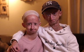 Hai anh em thiếu niên trông như ông, bà lão