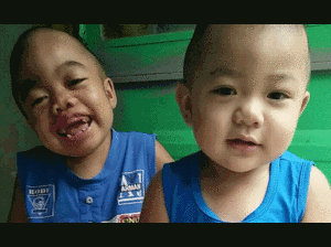 Hành trình đầy nước mắt của người mẹ chạy chữa cho hai con nhỏ mắc bệnh y học 'bó tay'