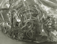 100 con giun ngoe nguẩy trong bụng bé 11 tuổi