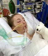 Bé gái 14 tuổi thiệt mạng vì nấm ăn mòn họng