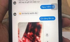 Hai sinh viên bị cướp, rạch đùi: Đại học Quốc tế TP.HCM lên tiếng