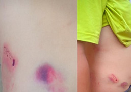 Chánh văn phòng huyện ủy giải thích lý do đánh tài xế nhập viện