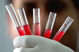 Rhnull - nhóm máu hiếm nhất thế giới, chỉ 43 người sở hữu