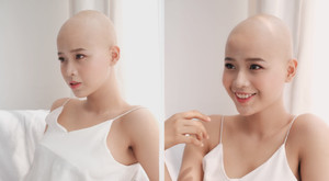 Nụ cười rạng rỡ của cô gái 19 tuổi mắc bệnh ung thư