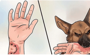 Bị chó dại cắn, 2 người ở Quảng Nam thiệt mạng