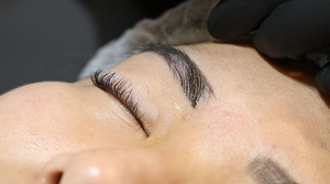 Người phụ nữ hôn mê sau xăm chân mày ở thẩm mỹ viện qua đời