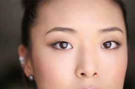 Cha mẹ mắt một mí có di truyền sang cho con?