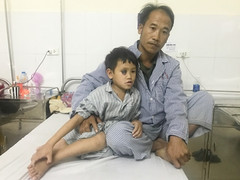 Cậu bé người Mông bị ung thư mắt và ước mơ chiến thắng bệnh tật để đến trường