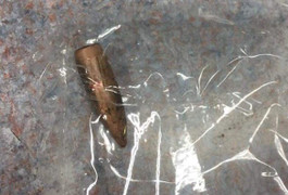 Người đàn ông sống gần trường bắn bị đạn lạc găm trúng đùi