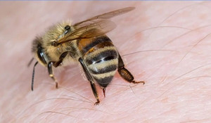 Bị ong vò vẽ đốt, người đàn ông nhồi máu cơ tim suýt chết