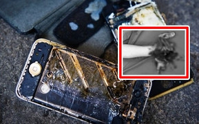 Dùng điện thoại khi đang sạc, thiếu niên bị cắt cụt bàn tay